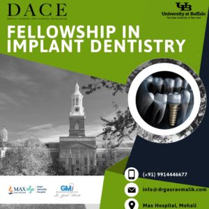 DACE - Fellowship in Implant Dentistry