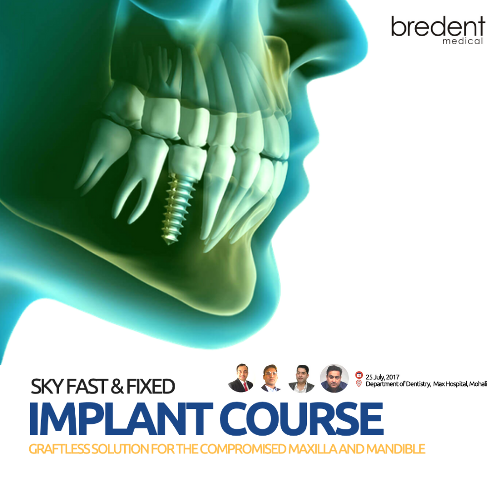 Sky Fast & Fixed Implant Course